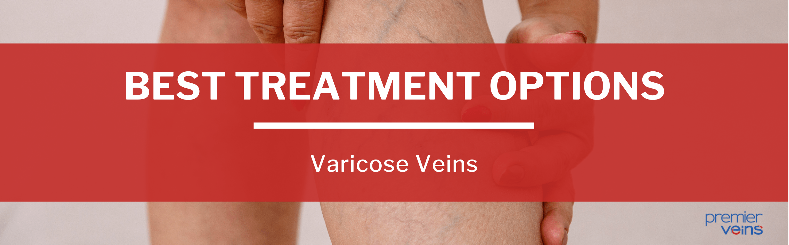 Which is the Best Varicose Vein Treatment?