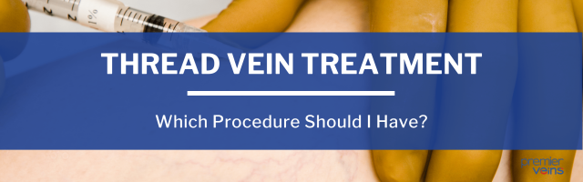Which Is the Best Treatment for Thread Veins in Legs?