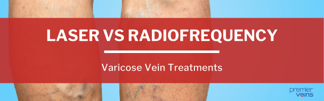 Treating Varicose Veins with Laser vs Radiofrequency Ablation