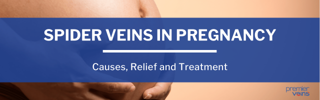 What Causes Spider Veins in Pregnancy, and How Can You Treat Them?