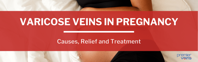 Varicose Veins in Pregnancy: Causes, Relief and Treatment